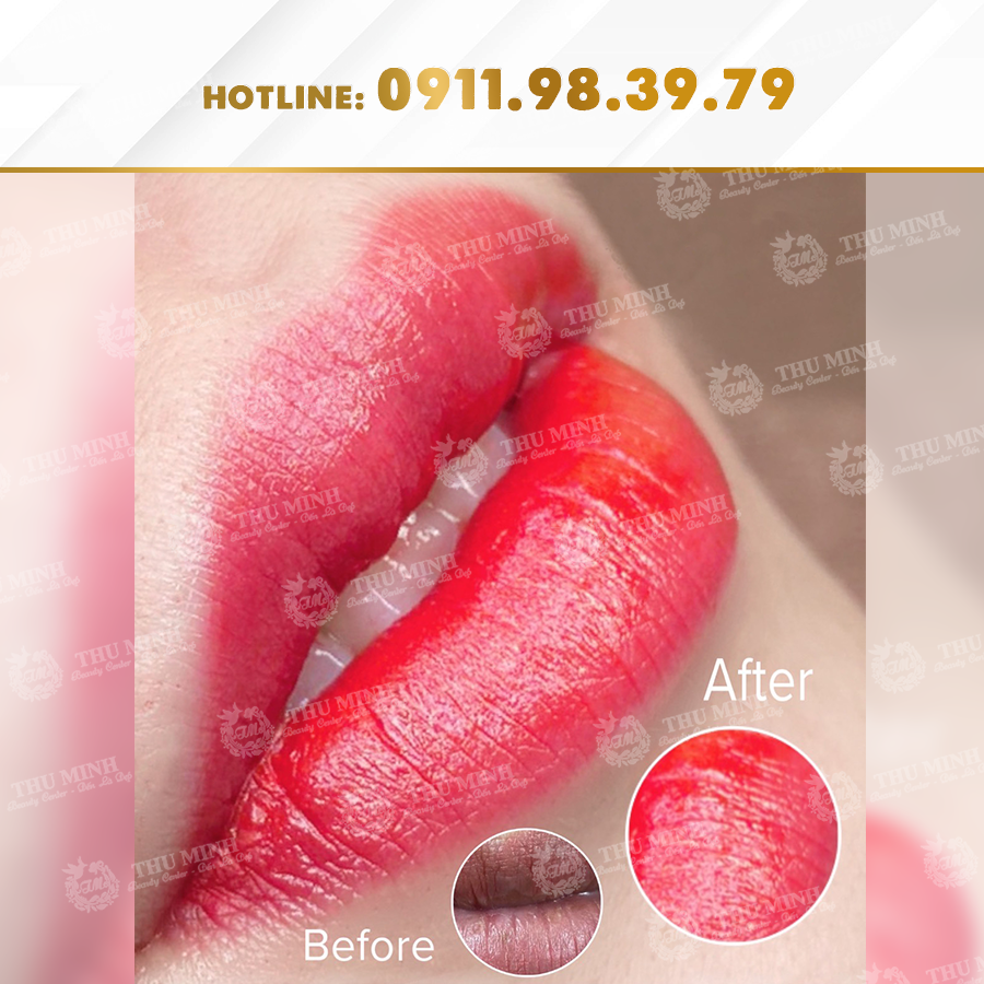 Phun xử lý môi hỏng