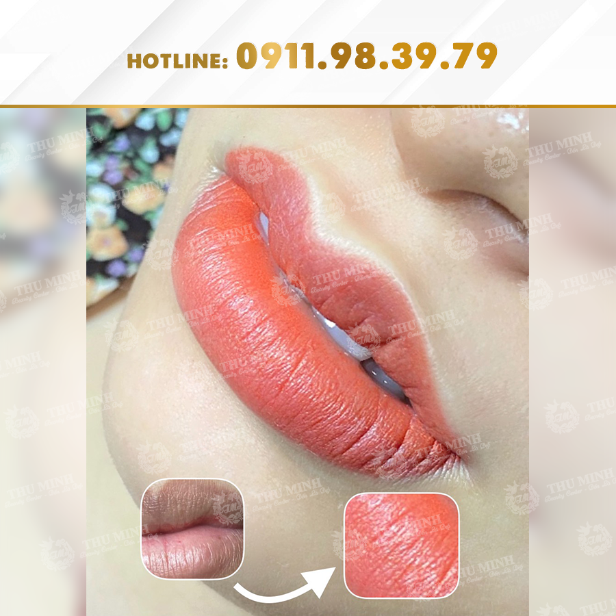 Phun xử lý môi hỏng