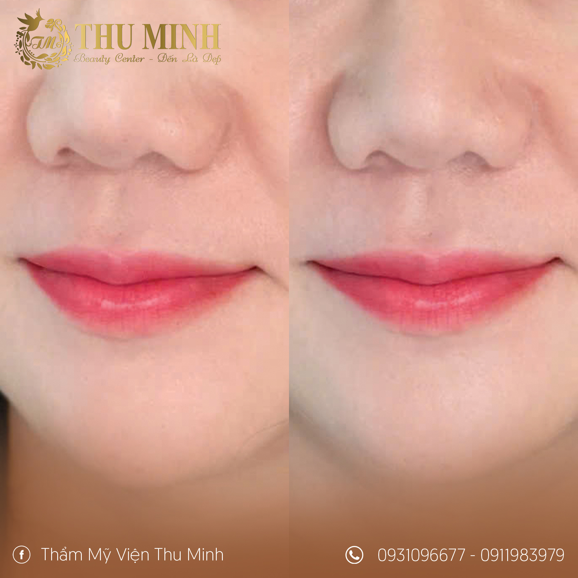 thẩm mỹ viện