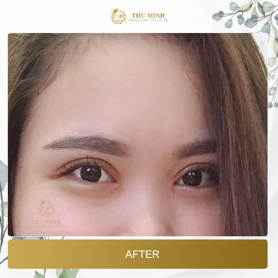 mở rộng khoé mắt