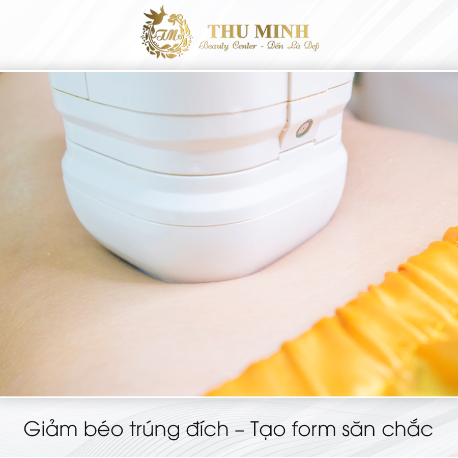 giảm mỡ bụng Lipo