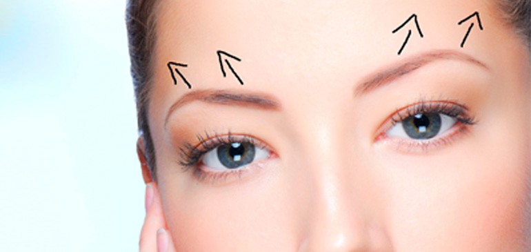 Spa nâng cung chân mày bằng chỉ an toàn, uy tín