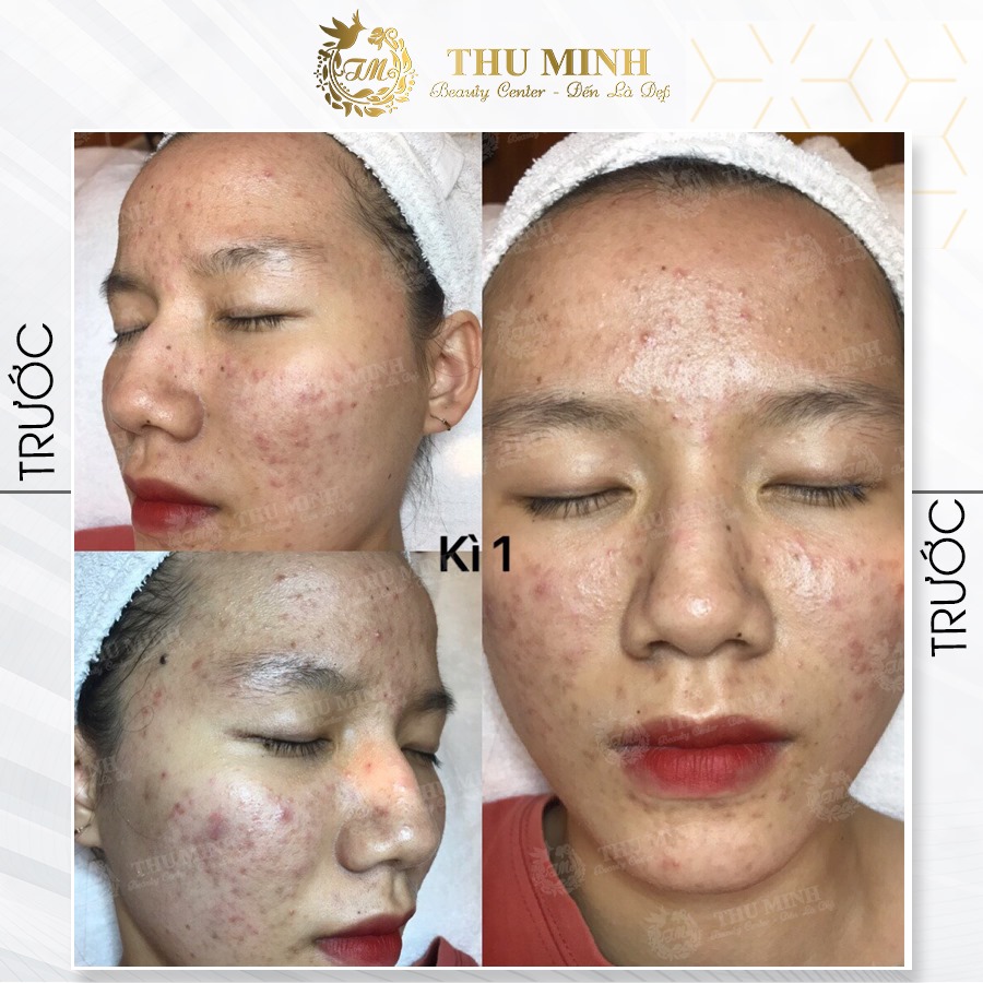 Công Nghệ IPL